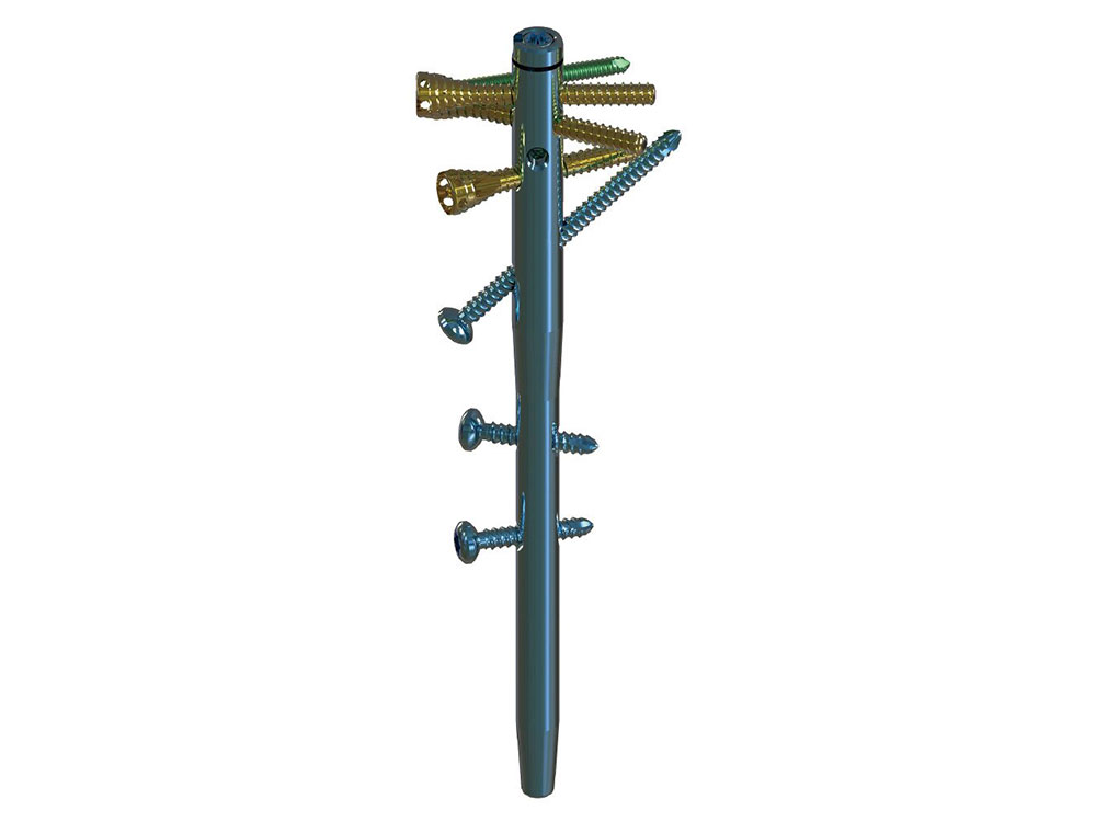 Orthopedic Consultation